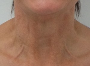 Neckbands_after2-300×222